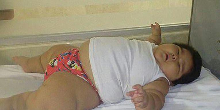 چاقی کودک ده ماهه پزشکان را متعجب کرد
