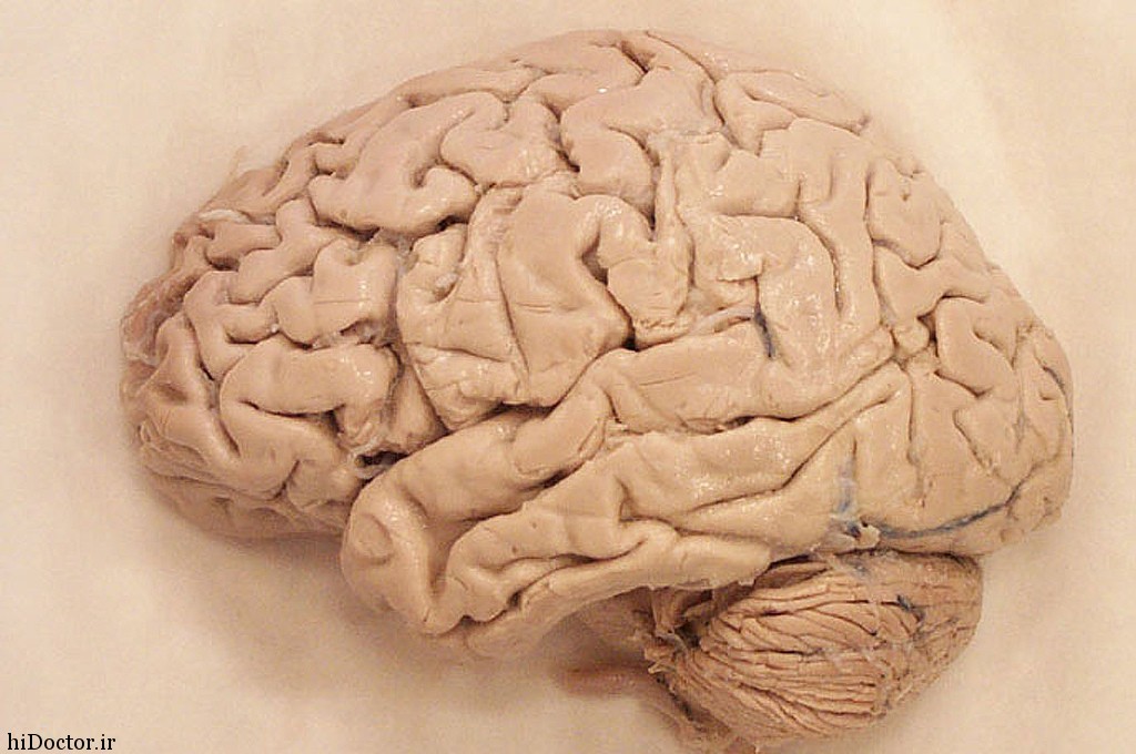 real-human-brain