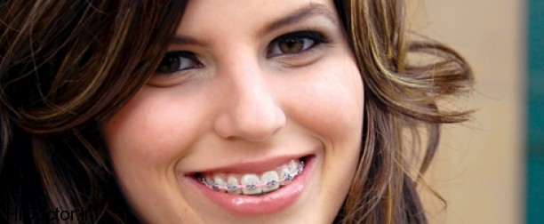 اگر دندانتان را ارتودنسی‌ کرده اید بخوانید 