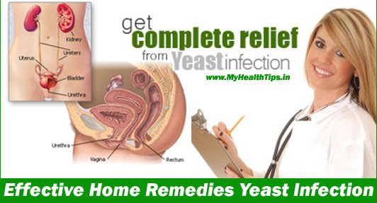 532x287xEffective-Home-Remedies-Yeast-Infection.jpg.pagespeed.ic.tkVarVLO-uqZ8ugAbWnM