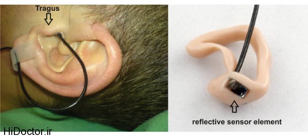 ear oximeter (7)