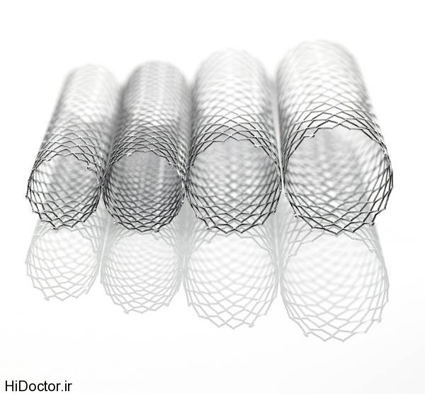 stent (1)