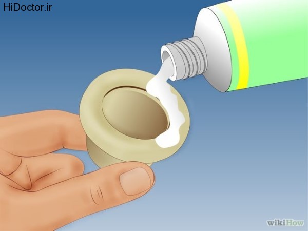 Cervical cap (3)