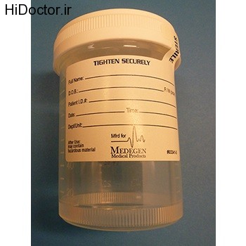 Sterile sample containers (15)