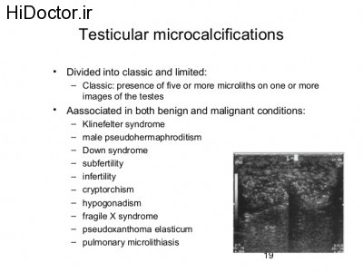 testicular-ca-edmond-19-638