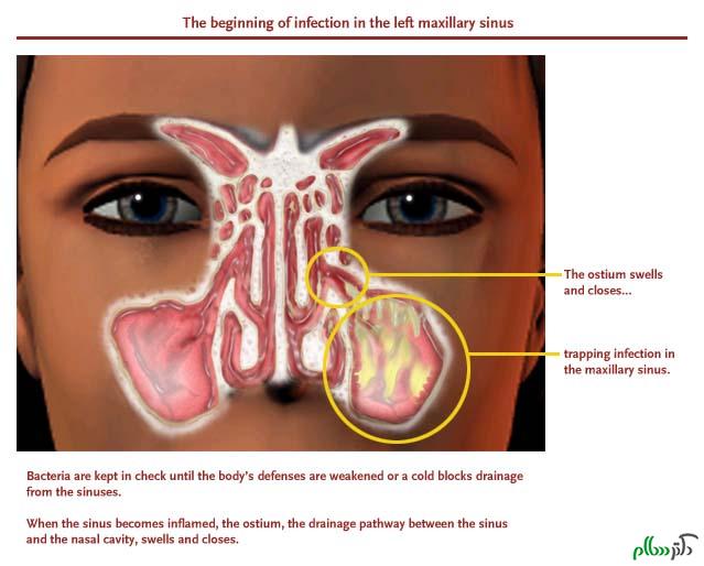 treatment-for-nasal-congestion_1