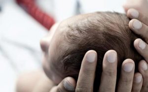 10 عارضه عجیب و معمول که در نوزادان رخ میدهد
