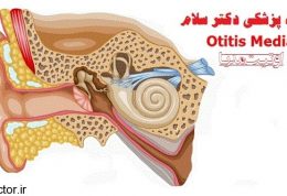 اوتیت حاد گوش میانی