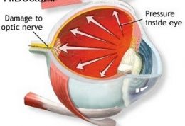 روش های معاینات چشم