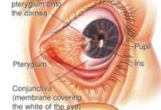 سوالات شایع درباره مشکلات چشم در دیابت