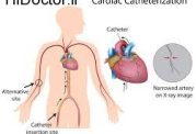 تشخیص بیماری های قلبی با کاتتریزاسیون قلبی