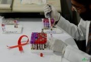 واکسن جدید HIV در جنوب آفریقا آزمایش می شود