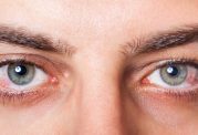 روزه گرفتن مبتلایان به بیماری چشمی