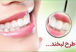 خدمات دندانپزشکی زیبایی و ترمیمی دکتر صدرا مقدم