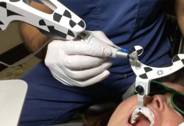 دکتر ادیب: سیستم نویگیشن ایمپلنت دندان راهنمای جراحی در آینده