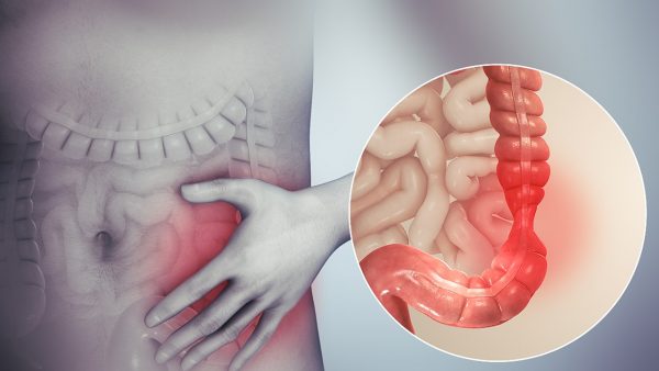 سایکوسوماتیک , سندروم روده تحریک پذیر, بی اشتهایی , پرخوری عصبی