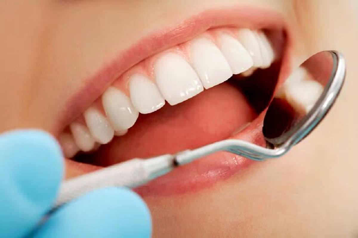 ۷ مورد از باورهای غلط درباره دندان
