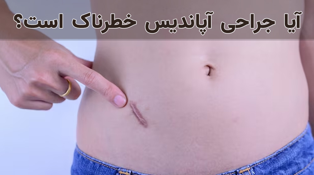 روند جراحی آپاندیسیت، چقدر ایمن است؟