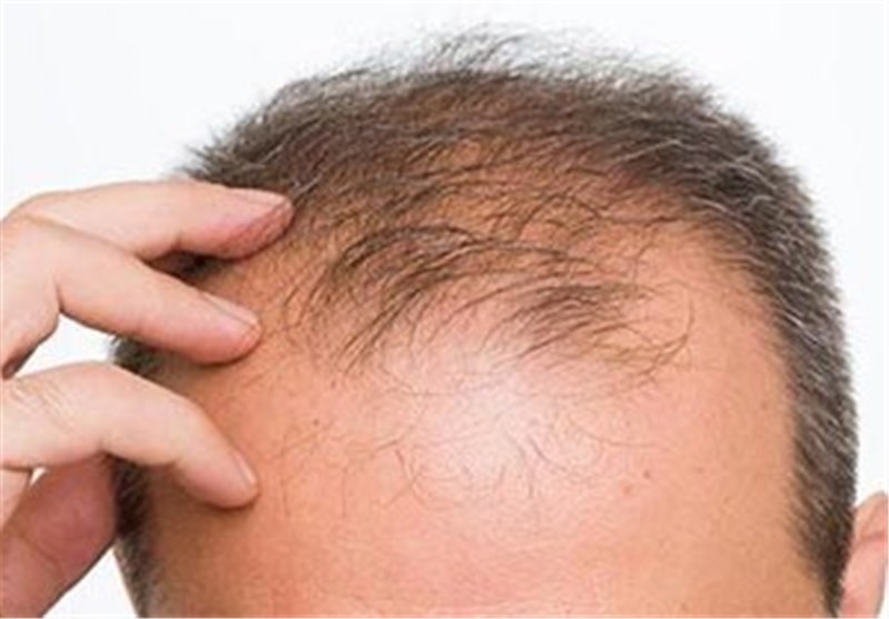 ۱۵ خاصیت اعجاب انگیز حنا در طب سنتی | از درمان ریزش مو تا تقویت ناخن‌ها