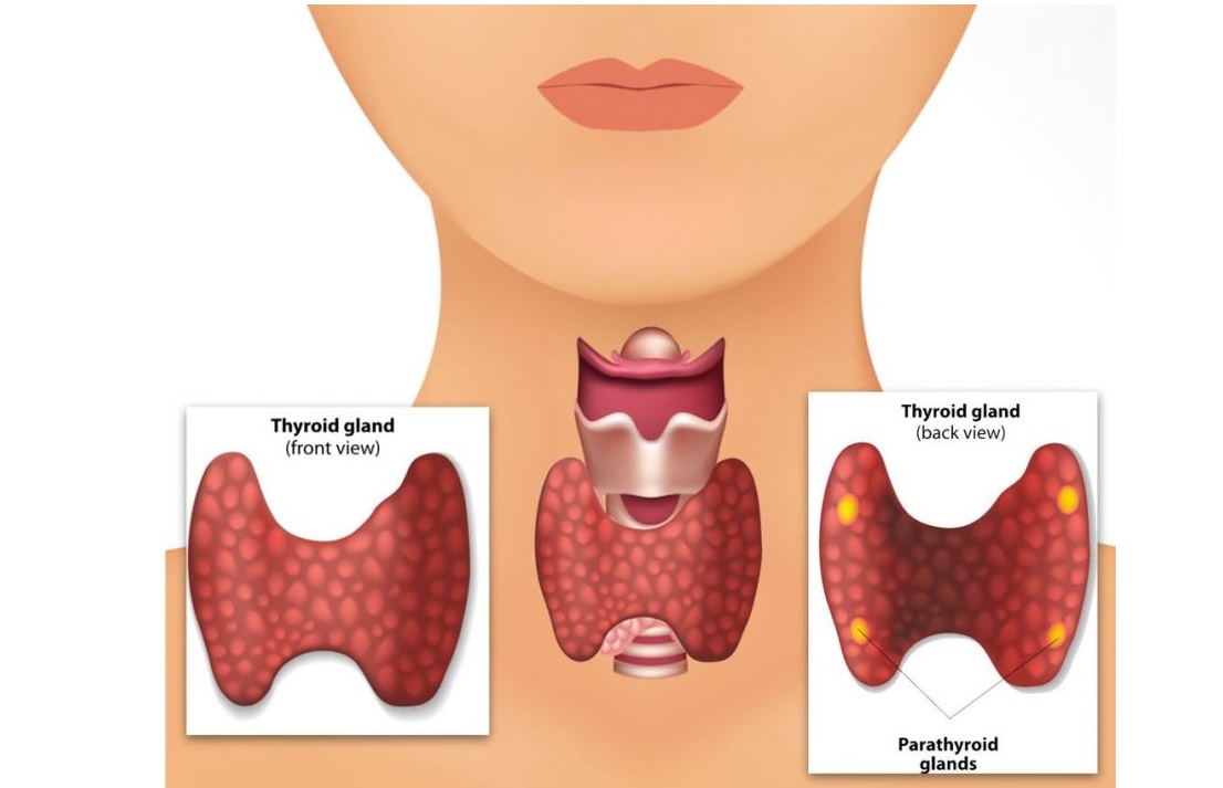 پاراتیروئید چیست و چه درمانی دارد؟