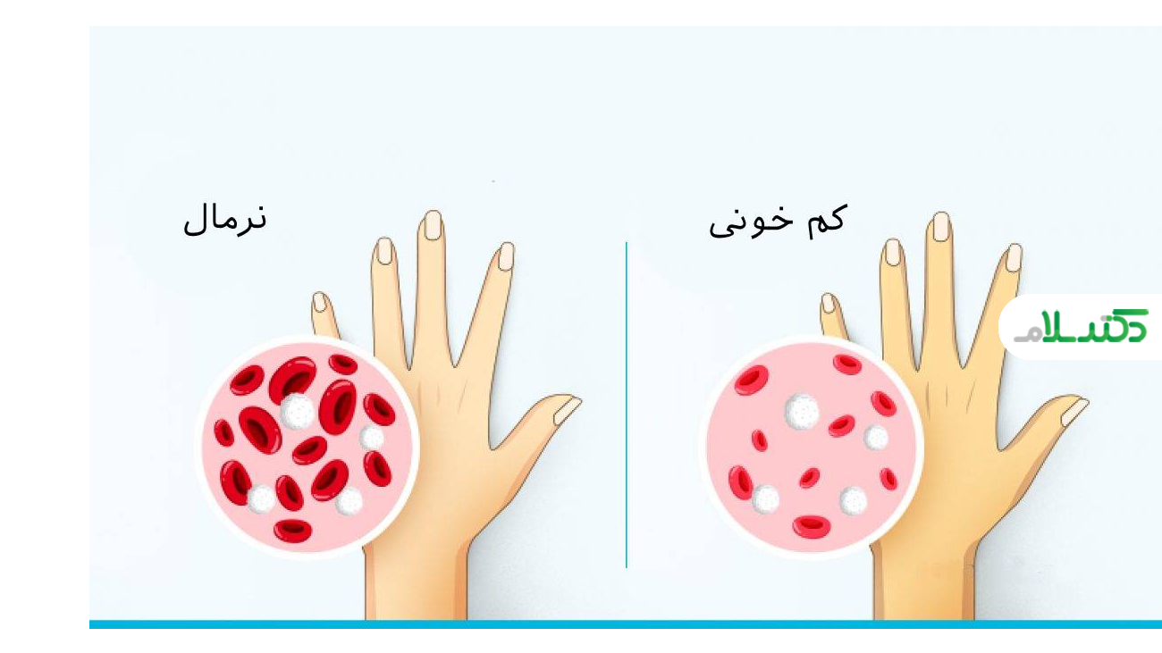 نقش اسید فولیک در پیشگیری از کم‌خونی