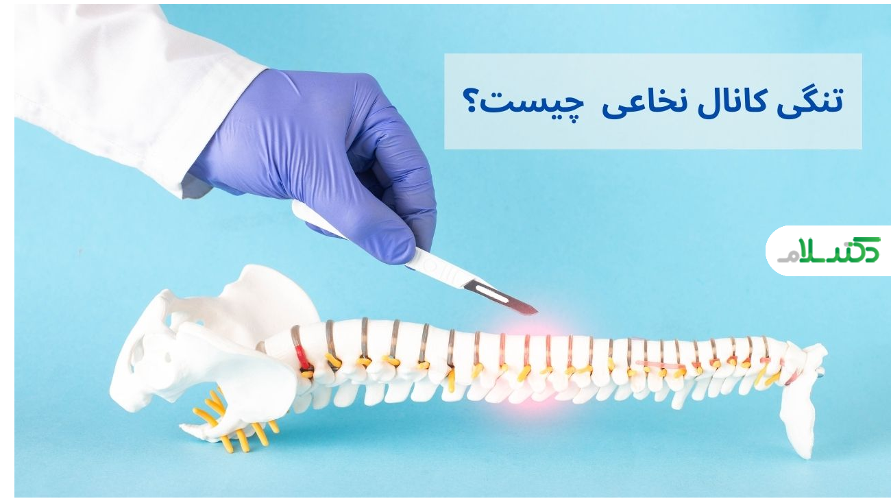 علل، علائم، تشخیص و درمان تنگی کانال نخاعی