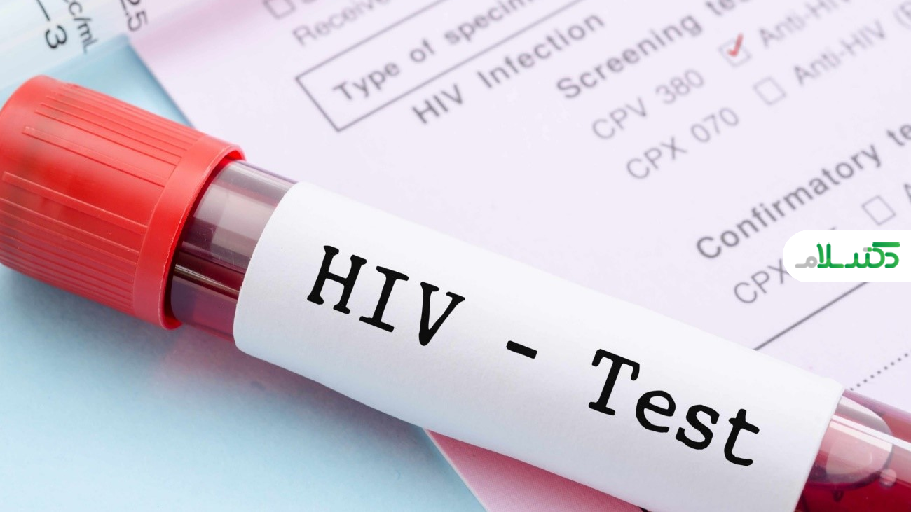 روش‌های تشخیص و آزمایش HIV